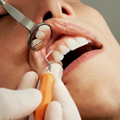 Dental Cleaning & Checkup